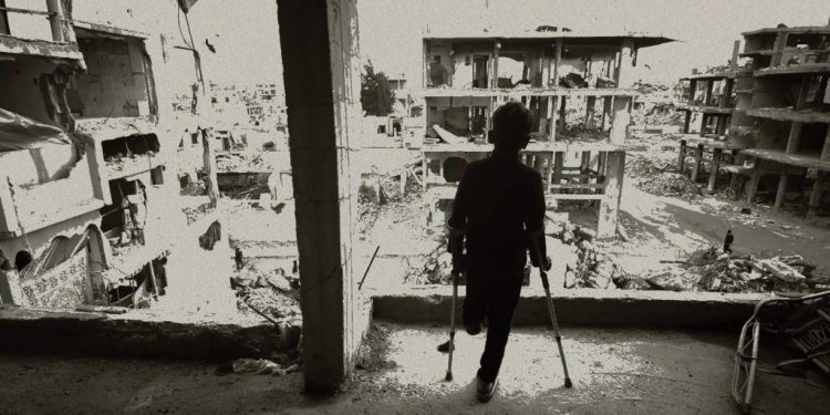 War Wounds That Never Heal: Amputation and Neglect in Southern Syria