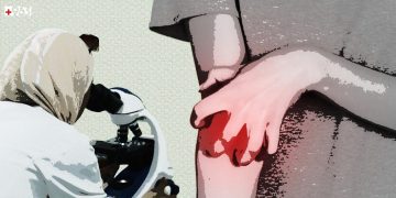 الجرب وأخواته: آفات جلدية تغزو أجساد السوريين