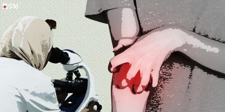 الجرب وأخواته: آفات جلدية تغزو أجساد السوريين