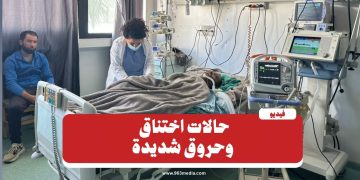 حرائق ريف اللاذقية.. حالات اختناق وحروق في المستشفى الجامعي