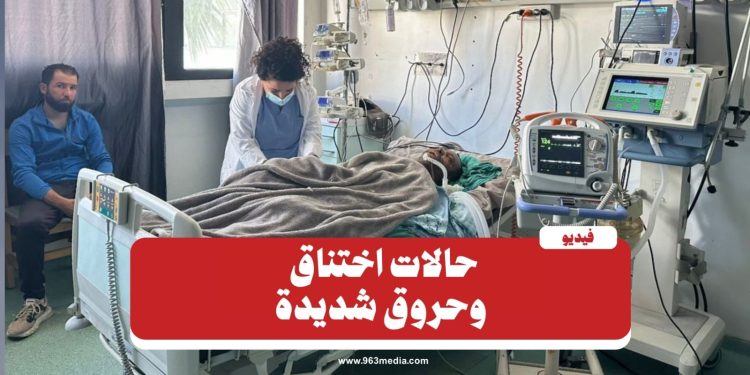 حرائق ريف اللاذقية.. حالات اختناق وحروق في المستشفى الجامعي