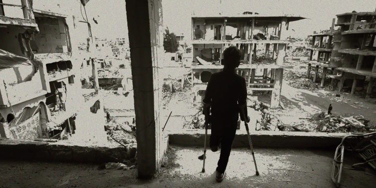 جرحى الحرب في الجنوب السوري بين ألم البتر وخذلان الجودة